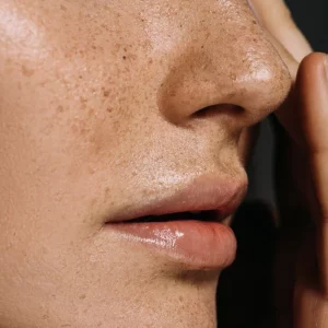 Hydrate_and_Plump_Your_Skin_with_the_Power_of_Hyaluronic_Acid_736x1104_crop_center